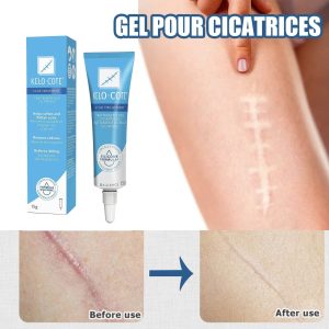 KELO-COTE® Scar Gel – Clinically Proven Scar Treatment